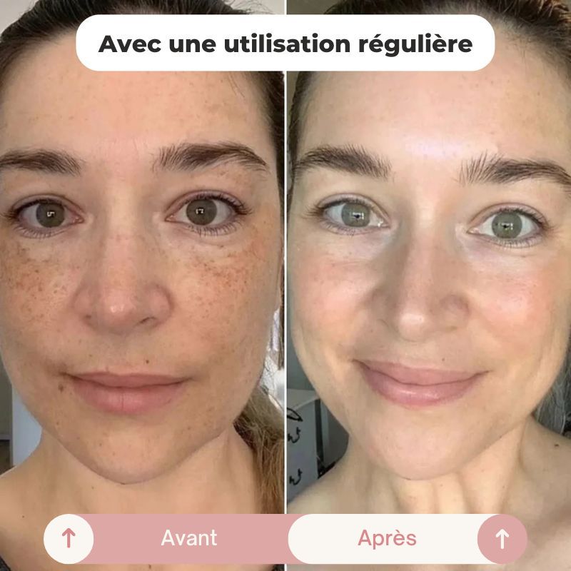 Brillance - Masque Coréen au Collagène Anti-Imperfections (75 mL)